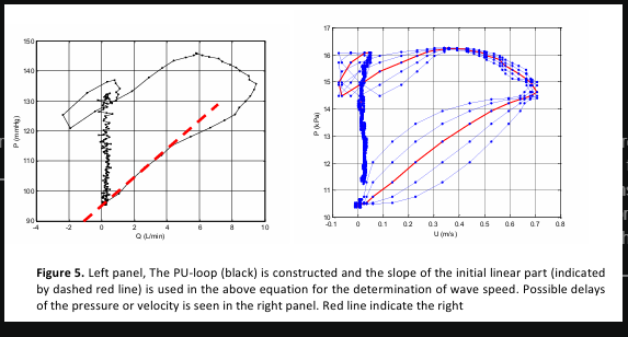 <p>Why can obtaining simultaneous measurement of pressure and velocity be a challenge</p>