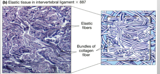 <p><span>Dense Irregular Connective Tissue Locations (Dense connective tissue)</span></p><p></p>