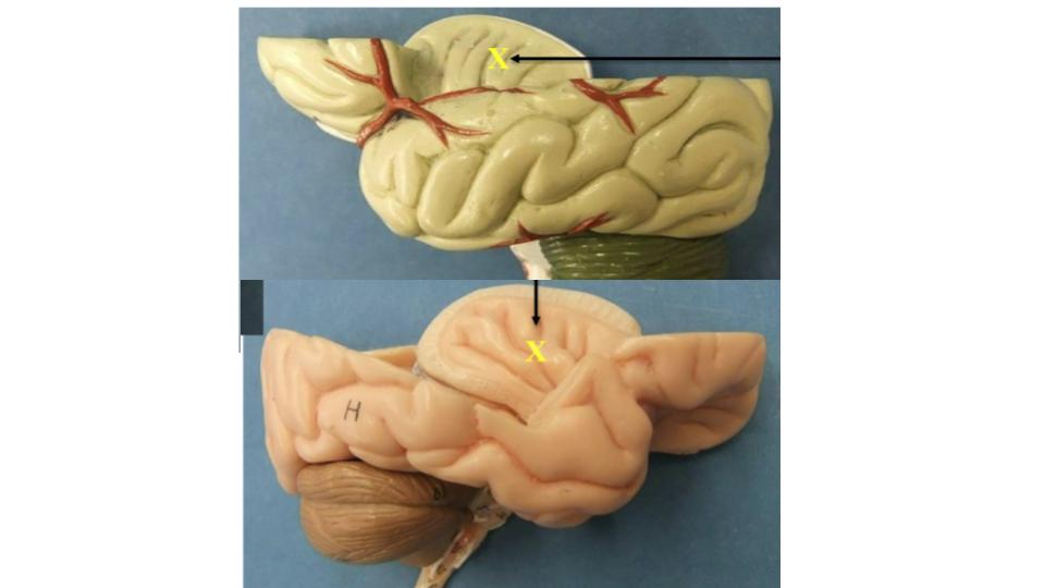 <p>lobe</p>