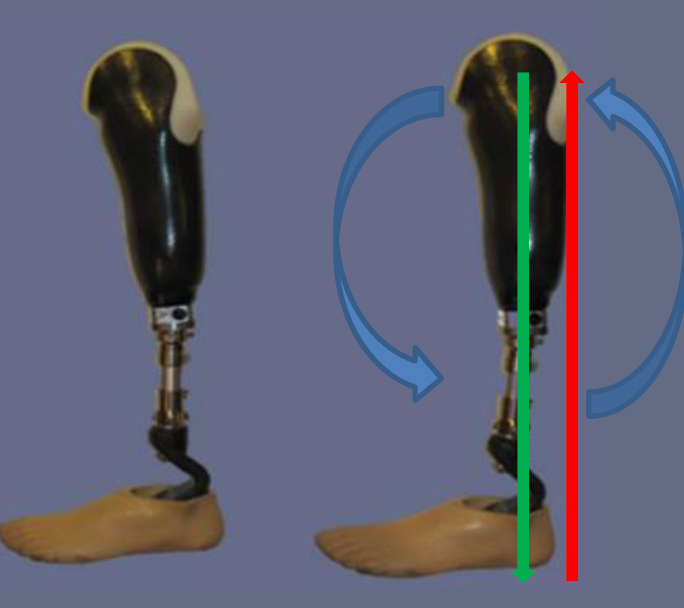 <p>posterior proximal, anterior distal </p>