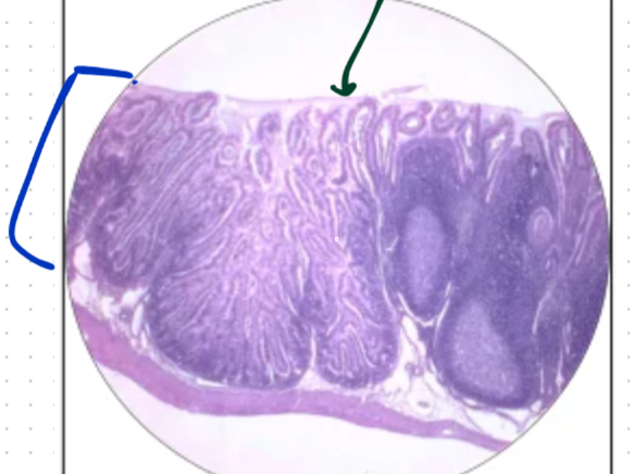 <p>What is this histology?</p>
