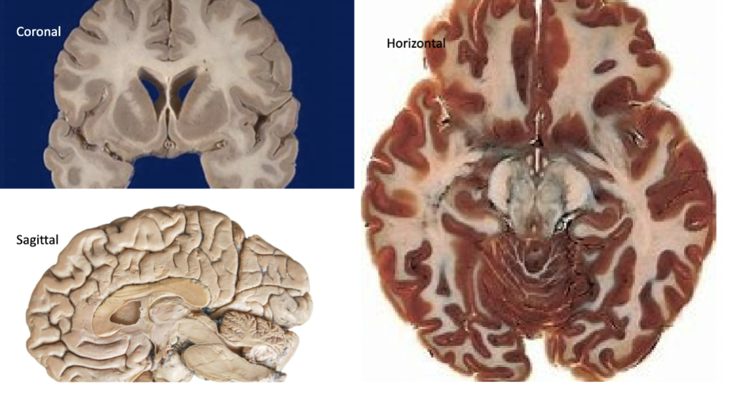 <p>axis of the forebrain- rostral to caudal</p><p>axis of the brainstem- rostral (toward the cerebrum) to caudal (toward the cauda equina)</p>