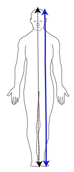 <p>Parasagittal Plane</p>
