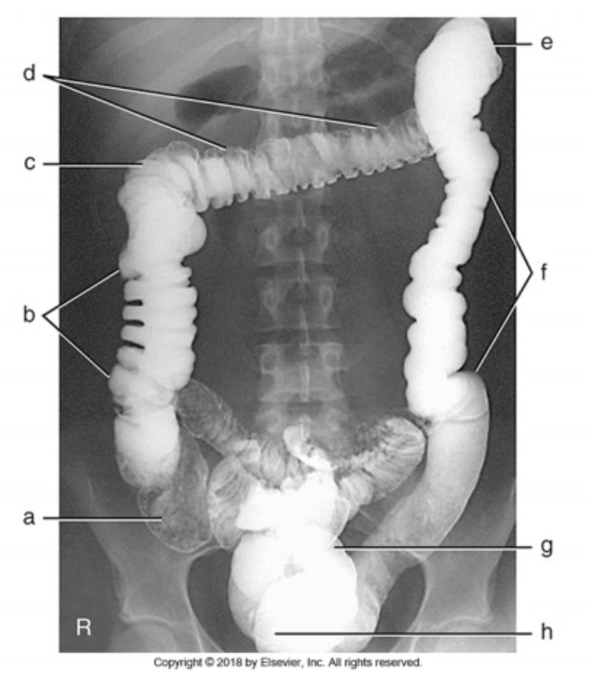 <p>Label this image A-H. For I- what is the projection? For bonus point- how do you know?</p>