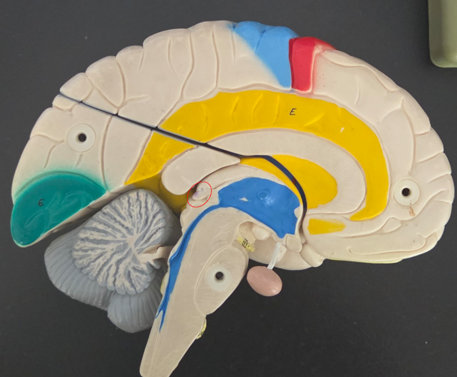 <p>a. What gland is this? </p><p>b. What is its function? </p>
