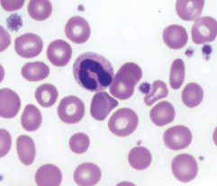 <p>Which WBC is this?</p>