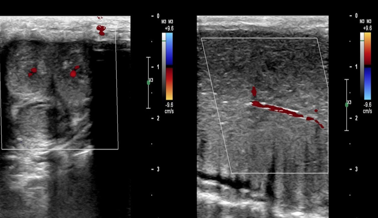 <p>Identify this image. </p>