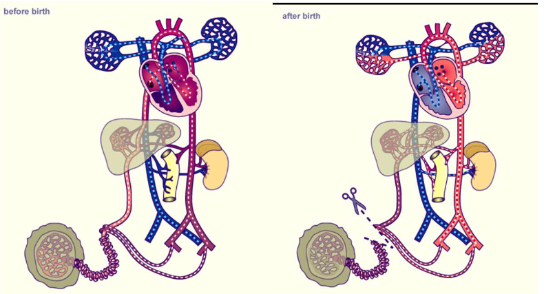 <p>-Shunts → er zijn 2 extracardiale shunts (ductus arteriosus en ductus venosus) en 1 intracardiale shunt (foramen ovale). Dit zijn eigenlijk “gaatjes” waardoor zuurstofarm en zuurstofrijk bloeden kunnen mengen.</p><p>-Longvaten → de foetus heeft een hoge longvaatweerstand waardoor er maar weinig bloed naar de longen stroomt. Dit is ook niet nodig aangezien de foetus nog niet ademt.</p><p>-Systeemcirculatie → de weerstand in de grote/systeemcirculatie is laag door een wijd openstaand placentair vaatstelsel.</p><p>Bij de geboorte veranderd de bloedsomloop:</p><p>-Wanneer de navelstreng wordt doorgeknipt neemt de systeemvaatweerstand toe.</p><p>-De ontplooiing van de longen zorgt voor een verlaging in de longvaatweerstand met als gevolg een verlaging van de afterload van het rechterventrikel en een verlaging van de druk in de longvaten. De hoeveelheid bloed dat door de longen stroom neemt erg toe waardoor de volumebelasting in de longvenen en daarmee de druk in het linkeratrium toeneemt.</p><p>-Door verlaging van de longweerstand tov de systeemvaatweerstand draait de shunt in de ductus arteriosus om van rechts-links naar links-rechts. Dit zorgt ervoor dat de doorstroming van de longen verder toeneemt. Uiteindelijk sluit de ductus arteriosus onder invloed van o.a. een hogere zuurstofspanning.</p><p>=> In de uren tot dagen na de geboorte is er een overgangsfase. Er kunnen hier nog periodes zijn waarin de bloedsomloop meer pre dan postnatale kenmerken vertoont: een hoge pulmonale vaatweerstand met rechts-linksshunting en hypoxie, dit kan leiden tot ernstige problemen.</p>