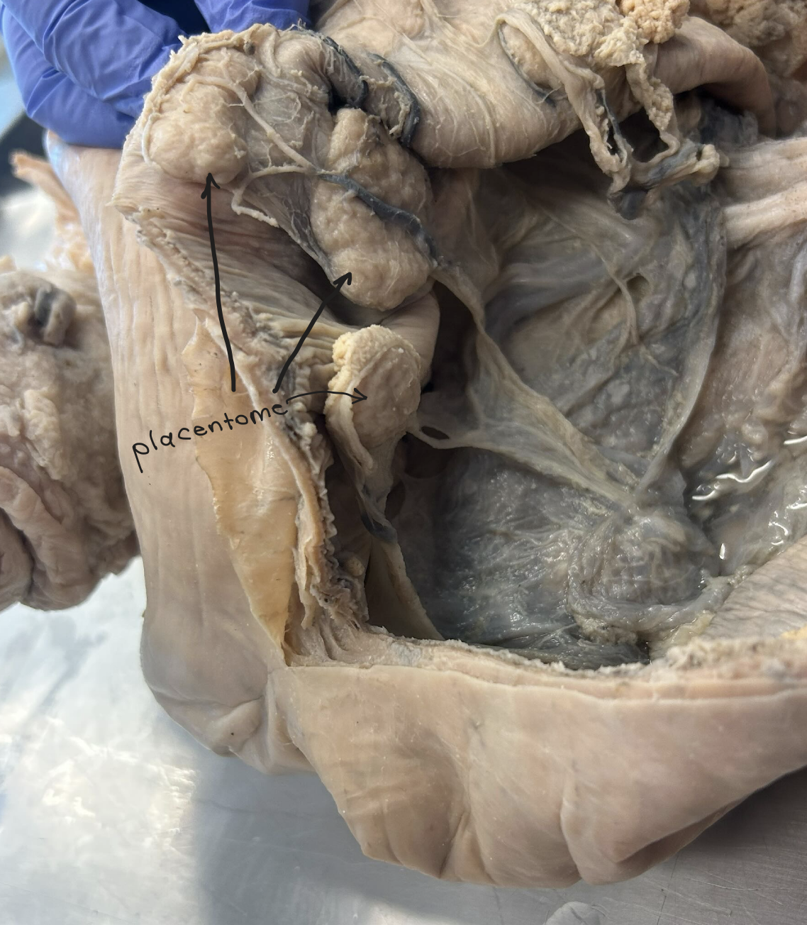 <p>Cow placenta (cotyledonary placenta)</p><p>Cotyledons and Caruncles attached = Placentome</p>