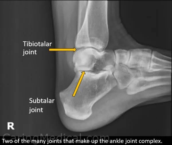 <p>Diarthroidal hinge joint.</p><p>dorsiflexion and plantar flexion.</p>