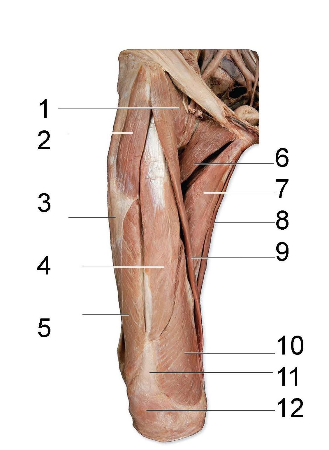 <p>What is identified in the photo 1-10</p>