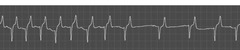 <p>Which ECG pattern is this in a horse?</p>