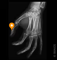 <p>What joint is this? </p>