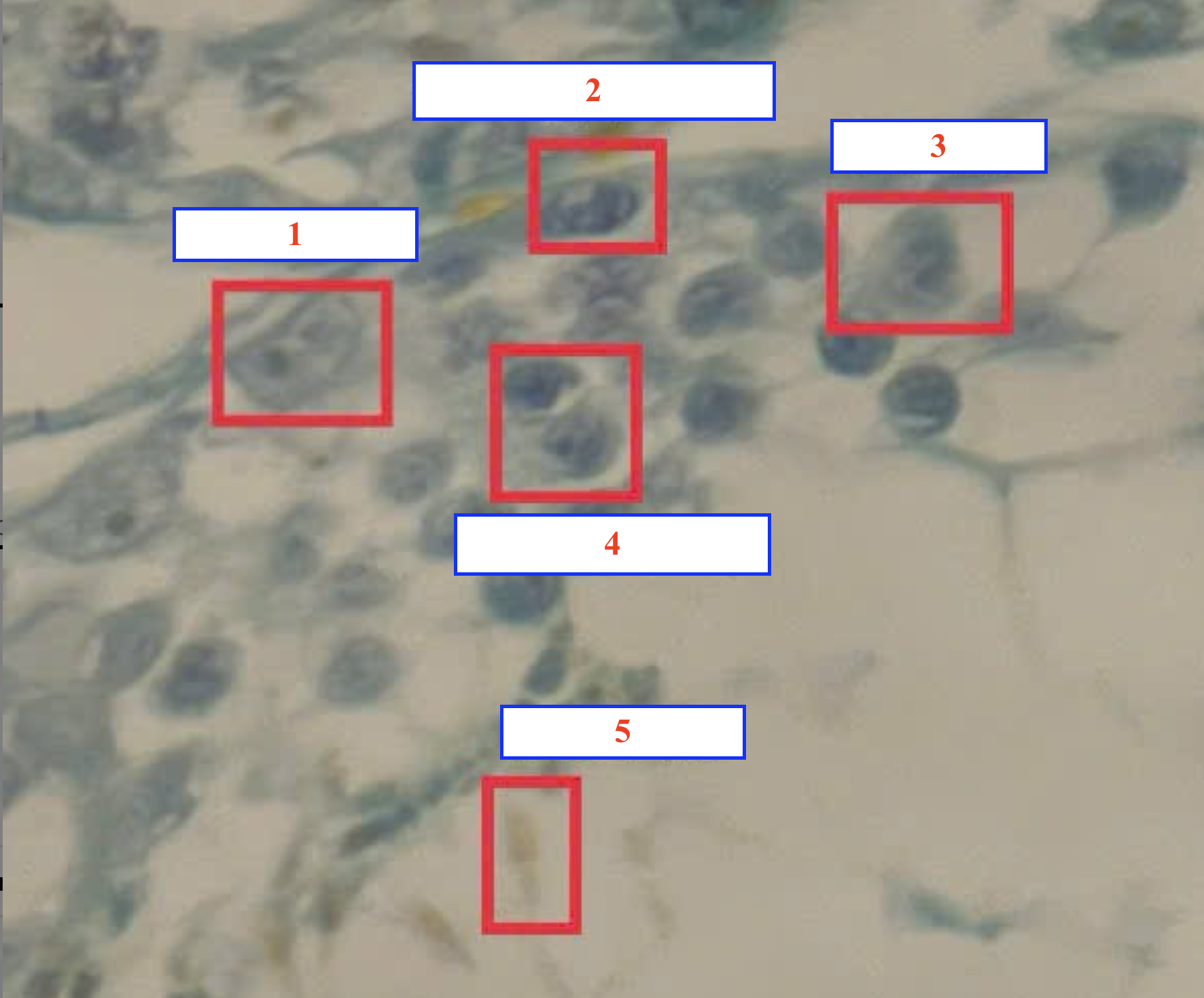 <p>Tế bào gì ?</p>