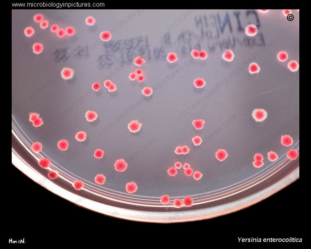 <ul><li><p>Selective for GNRs; used to recovery primarily <em>Yersinia enterocolitica</em></p><ul><li><p>Ingredients inhibit most organisms found in the stool </p></li></ul></li><li><p>Differentiates mannitol fermenters</p></li></ul><p></p><p>Interpretation</p><ul><li><p>Fermenter: pink </p><ul><li><p><em>Yersinia</em>: bulls eye colonies with pink center and clera periphery </p></li></ul></li><li><p>Nonfermenter: clear </p></li></ul><p></p>