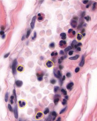 <p>Identify the circled cells</p>
