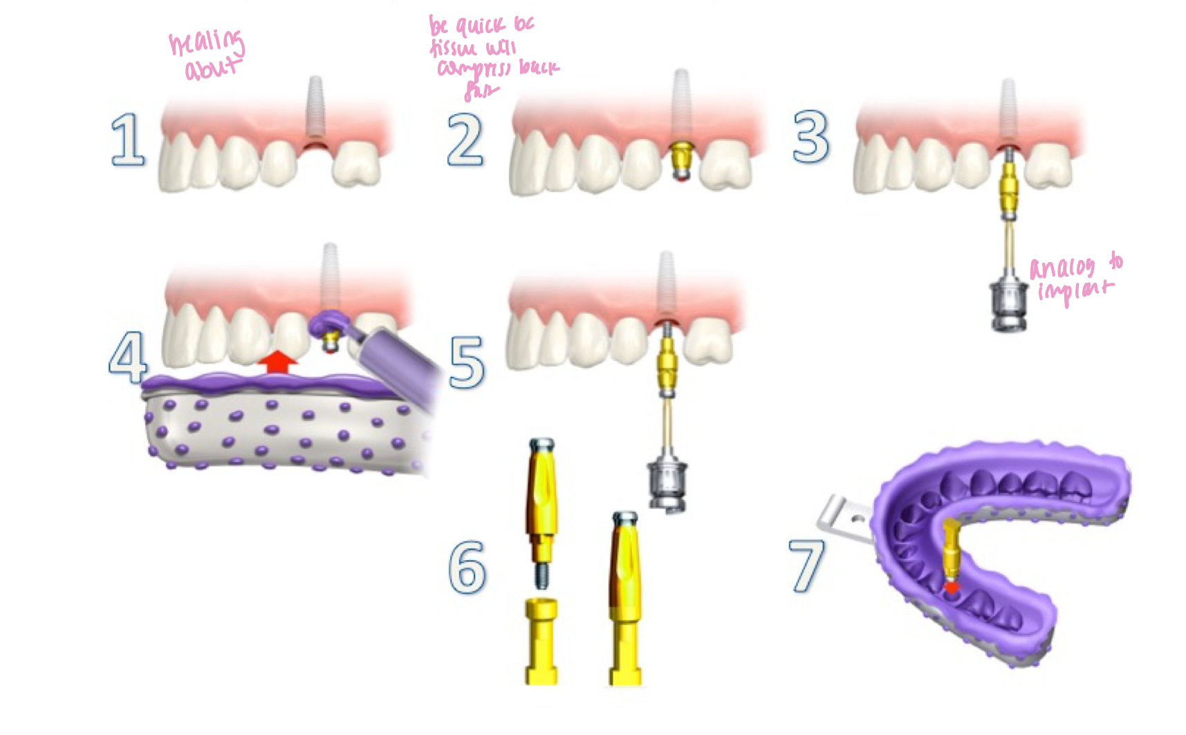 <p>ID the technique:</p>