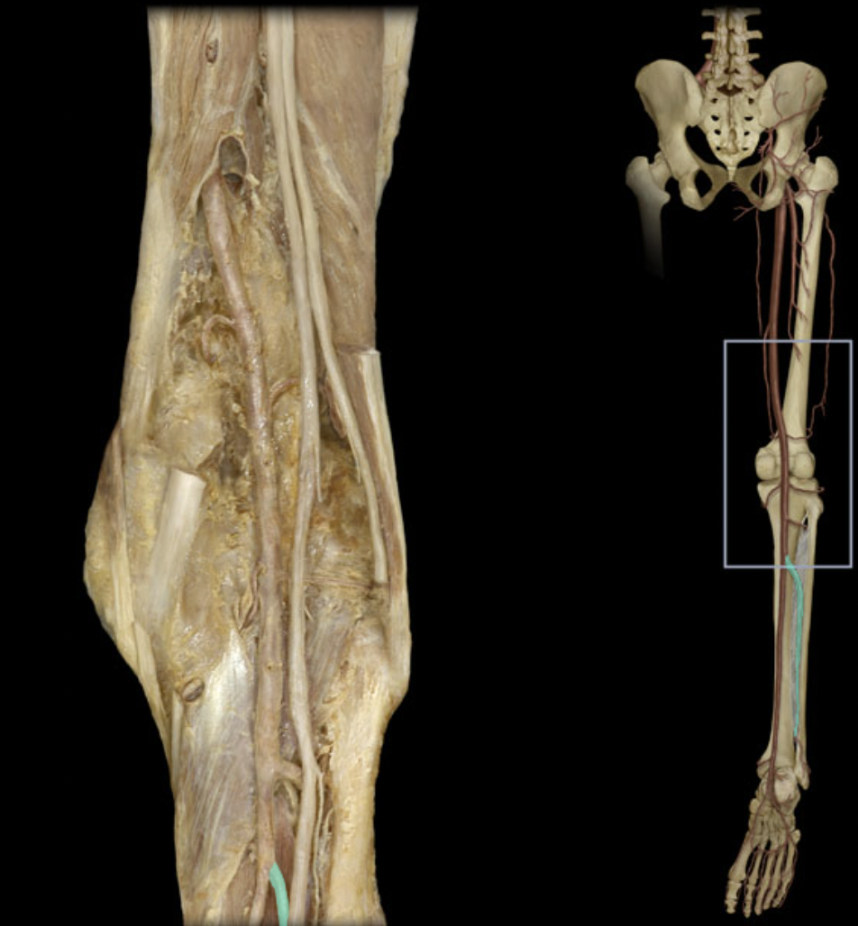<p>Identify the blood vessel of the lower extremity</p>