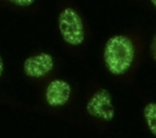 <p>bright dots scattered in nucleus</p>