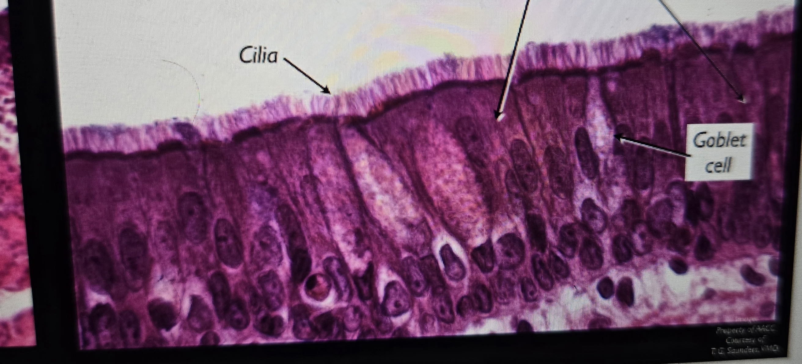 term image