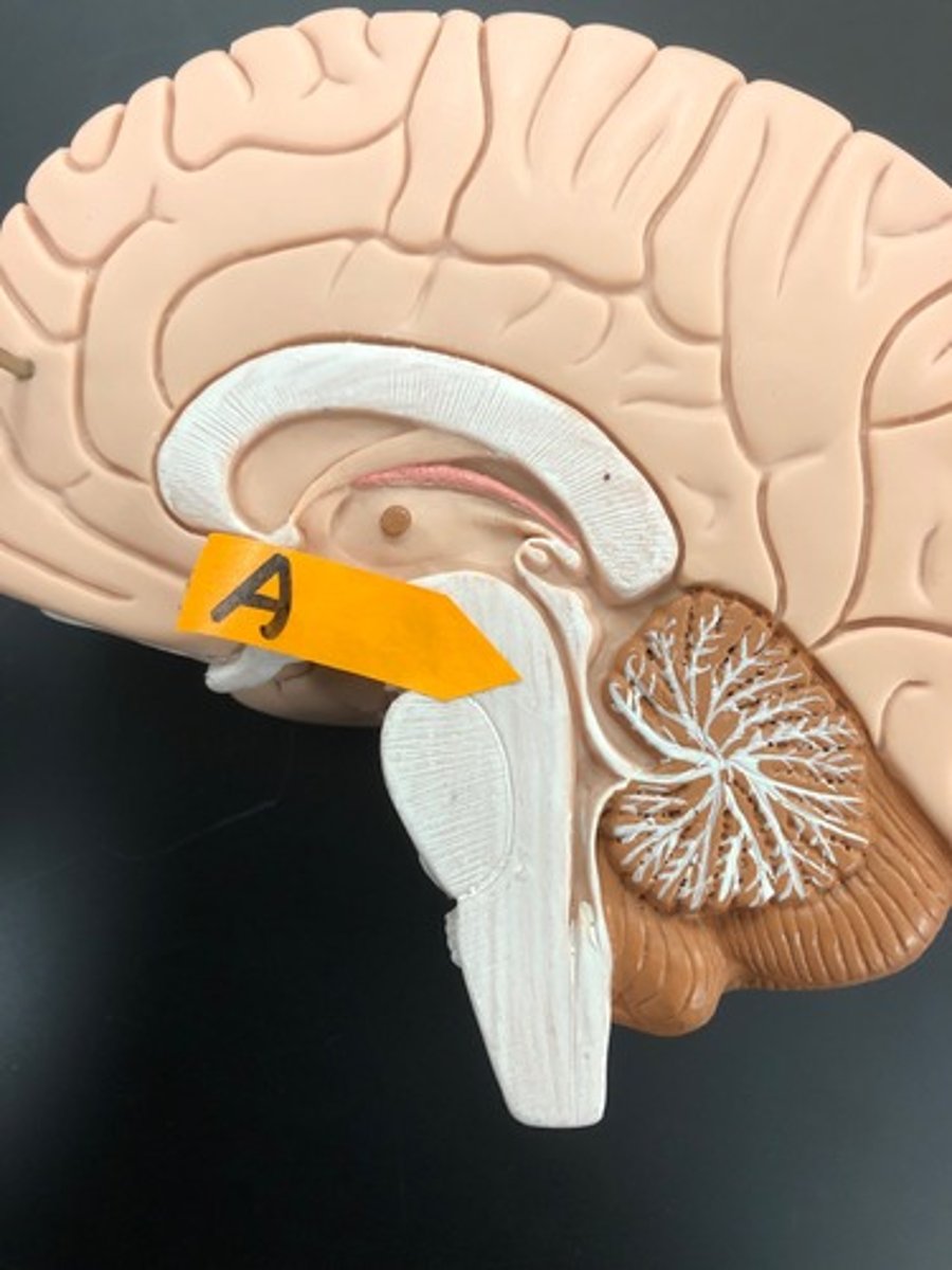 <p>Identify this area of the brain stem.</p>