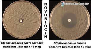 <p>what bacteria is <strong>sensitive</strong> to novobiocin ?BA</p>
