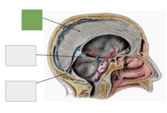 <p>This is the</p>