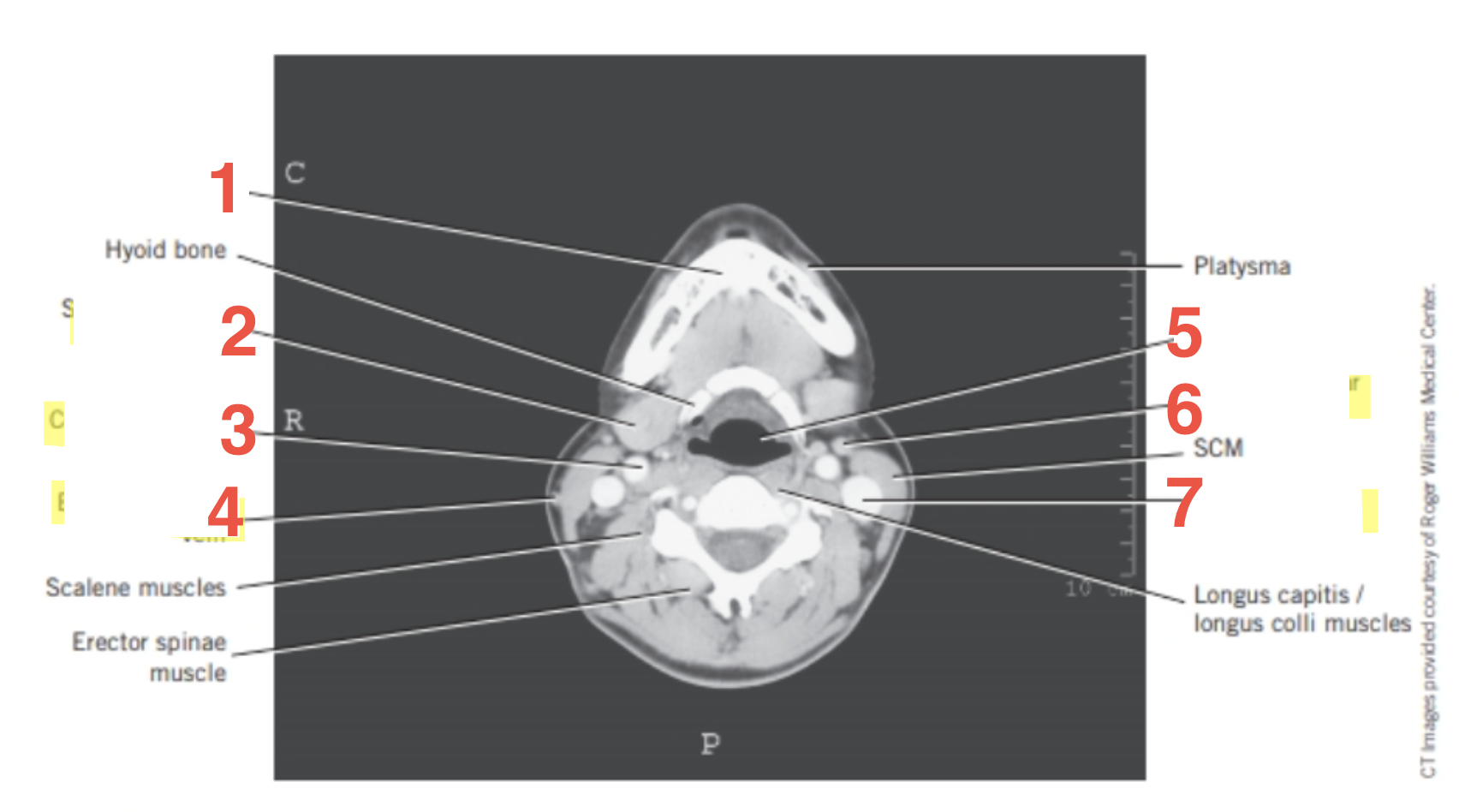 <p>6</p>
