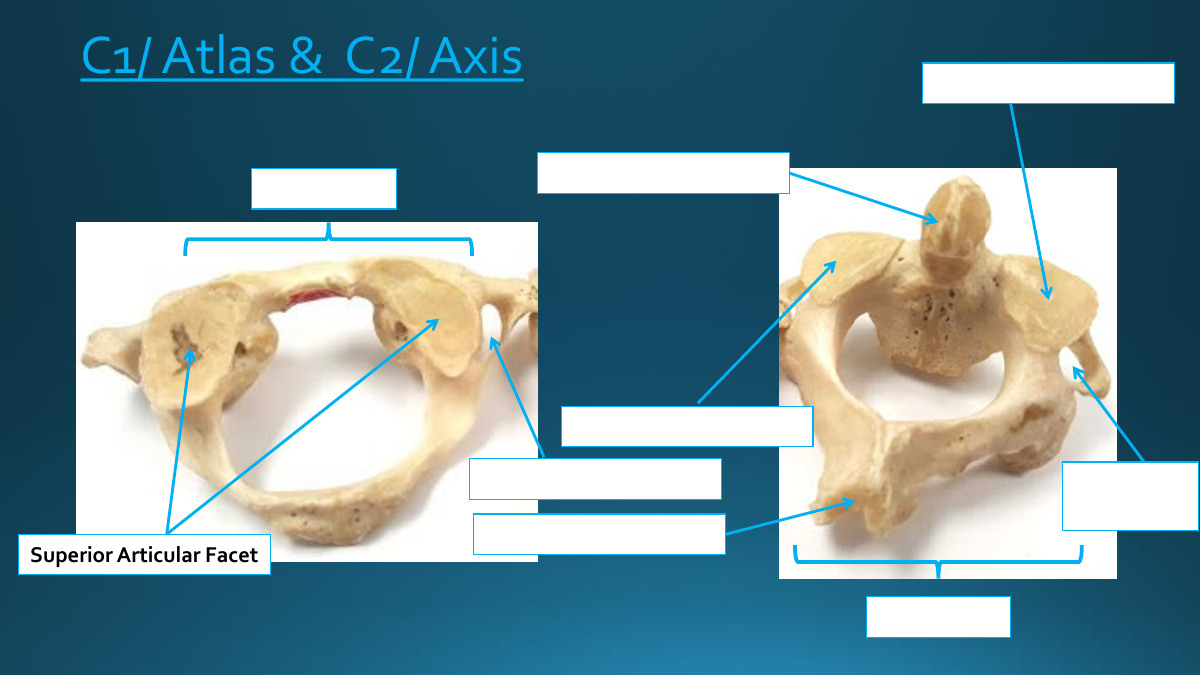 <p>Superior Articular Facet</p>