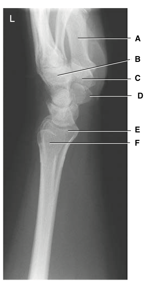 <p>D</p>