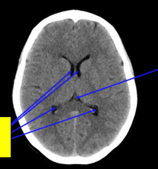 <p>Name the structure</p>