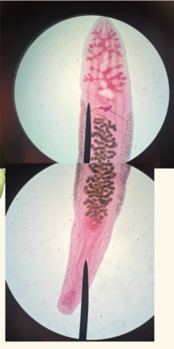 <p>subkingdom eumetazoa</p><p>phylum platyhelminthes</p><p>class trematoda</p><p>mouth, intestine, uterus, testis</p>