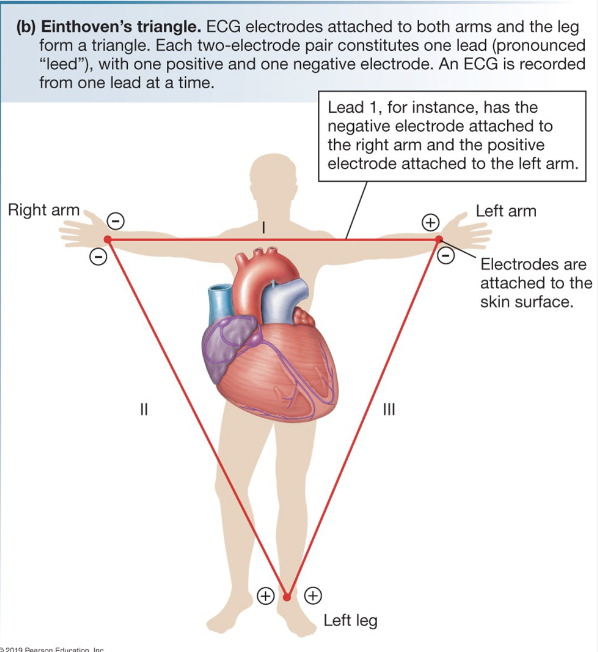 <ul><li><p>Action potential for contractile</p></li><li><p>Depolarization = Na<sup>+</sup></p></li><li><p>Plateau = Ca<sup>2+</sup></p></li><li><p>Re-polarization = K<sup>+</sup></p></li><li><p>Note time frame: hundreds of ms. Skeletal muscle = 10s of ms</p></li><li><p>Electrocardiogram (EKG/ECG)</p></li><li><p>Measures overall electrical activity of heart outside of body</p></li><li><p>Pattern based on position of leads</p></li></ul><p></p>