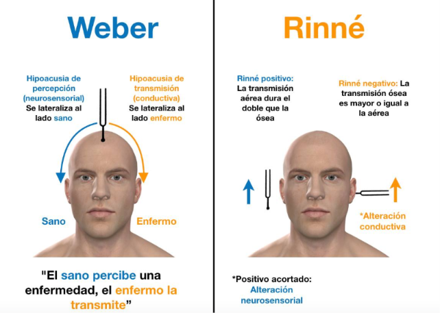 <ul><li><p><strong>VA > VO (Rinne Positiu)</strong>.</p></li><li><p><strong>Weber lateralitza a l'oïda SANA</strong>.</p></li><li><p><strong>Clínica</strong><em>:</em> Escolta malament i <strong>NO entén les paraules</strong> (intel·ligibilitat alterada).</p></li><li><p><strong>Top EIR:</strong> Presbiacúsia (edat), ototòxics, Ménière.</p></li></ul><p></p>