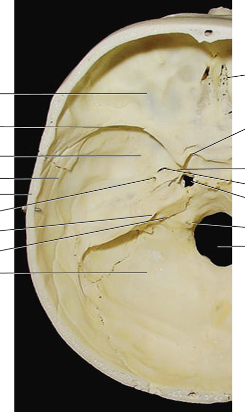 <p>Inner side of wall of hollow structure</p>