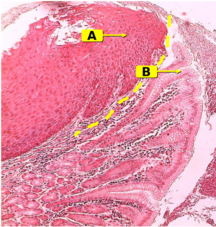 <p>gastro-esophageal junction</p><ul><li><p>A: esophagus</p><ul><li><p>lined with stratified squamous epithelium</p><ul><li><p>protection</p></li></ul></li></ul></li><li><p>B: stomach</p><ul><li><p>lined with simple columnar epithelium</p><ul><li><p>allows for absorption and secretion</p></li></ul></li></ul></li></ul><p></p>