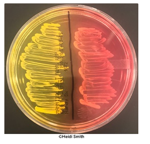 <p><em>E. coli </em><span>is an intestinal organism, and </span><em>Staphylococcus epidermidis </em><span>resides on the skin. What do you hypothesize will occur when both are inoculated onto mannitol salt agar?</span></p>