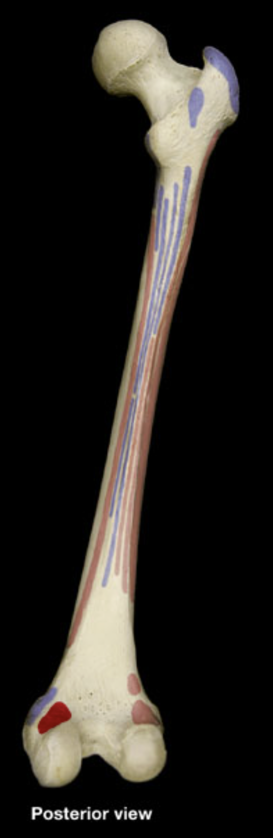 <p>medial condyle of femur</p>