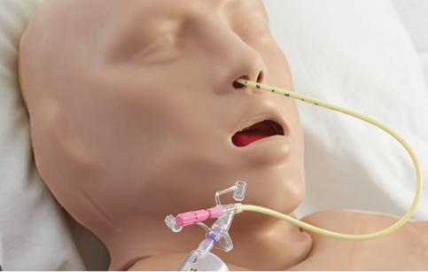 <p>is inserted into the nose and goes into the stomach</p>