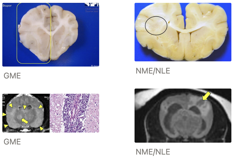 <p><u>Types:</u></p><ol><li><p><strong>Granulomatous meningoencephalitis (GME)</strong> = Swelling of brain on MRI → Less severe</p></li><li><p><strong>Necrotising meningoencephalitis (NME)</strong> = Soft tissue loss → More severe</p></li></ol><p><u>Diagnosis:</u> Presumptive diagnosis based on signalment, history and neurolocalisation →</p><ol><li><p>CSF result (± mononuclear pleocytosis and high protein)</p></li><li><p>MRI appearance</p></li><li><p>Response to treatment</p></li><li><p>Definitive diagnosis requires histopathology to differentiate GME from NME/NLE</p></li></ol><p><u>Clinical Signs:</u> Multifocal CNS signs with predominant forebrain involvement</p><ul><li><p>± Cranial nerve dysfunction (i.e. brainstem involvement)</p><ol><li><p>Ocular GME form → Involves optic nerve</p></li><li><p>Idiopathic hypertrophic pachymeningitis (form) → Cranial nerve compression</p></li></ol></li></ul><p><u>Signalment:</u> Young to middle-aged dogs (4 - 8yr)</p><ul><li><p>GME: Small breeds (eg. terriers and poodles)</p></li><li><p>NME: Pugs, Chihuahuas, Maltese, Pekingese, Shih Tze, West Highland White Terriers, Papillons, Coton du Tulear, Griffon Bruxellois</p></li><li><p>NLE: Yorkshire Terriers, French Bulldogs</p></li><li><p>Eosinophilic ME: Medium to large breeds</p></li><li><p>Idiopathic hypertrophic pachymeningitis: Greyhounds/lurchers, labradors</p></li></ul><p><u>Treatment:</u> Multimodal immunosuppression</p><ul><li><p>eg. Prednisone ± cytarabine, cyclosporine, azathioprine, mycophenolate mofetil</p></li><li><p><strong>Duration:</strong> MONTHS to YEARS with very slow tapering (potentially lifelong)</p><ul><li><p>Cessation of treatment is fatal</p></li></ul></li></ul><p><u>Prognosis:</u> Up to 30% mortality BEFORE treatment (survival of 1 - 2 months from diagnosis → May survive years)</p><ul><li><p>Survival depends on MUO severity (worse outcome for NME/NLE)</p><ul><li><p>Better outcomes for treatments than what is published (can only publish with definitive diagnoses of disease which requires PM biopsy and histology)</p></li></ul></li></ul><ul><li><p>Potential for permanent deficits</p></li></ul><p></p>
