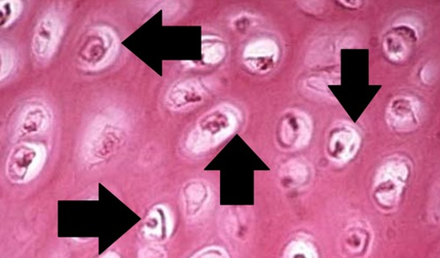 <p>Small spaces that contain chondrocytes or osteocytes.</p>