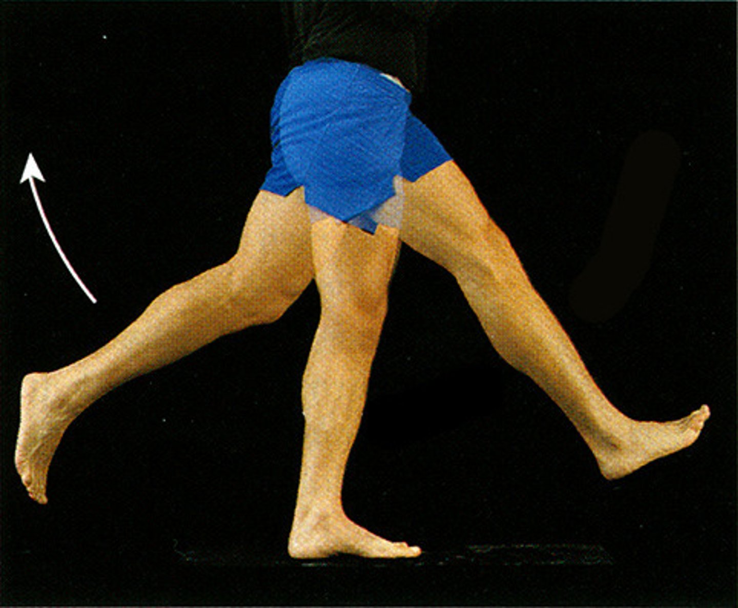 <p>the extreme or overextension of a limb or body part beyond its normal limit</p>