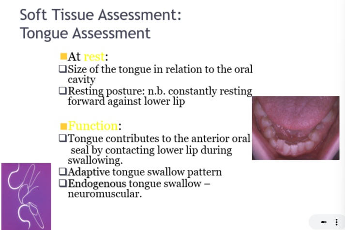 <ul><li><p>Rest: size of the tongue in relation to oral cavity, resting posture</p></li><li><p>Function: adaptive tongue swallow pattern, endogenous tongue swallow - neuromuscular/down syndrome</p></li></ul><p></p>