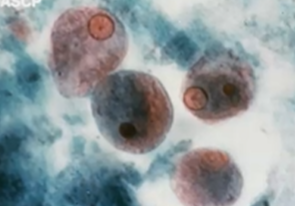 <p><span style="background-color: rgba(0, 0, 0, 0); line-height: 19.7625px;">What is the species seen in this photo and WHY?</span></p>