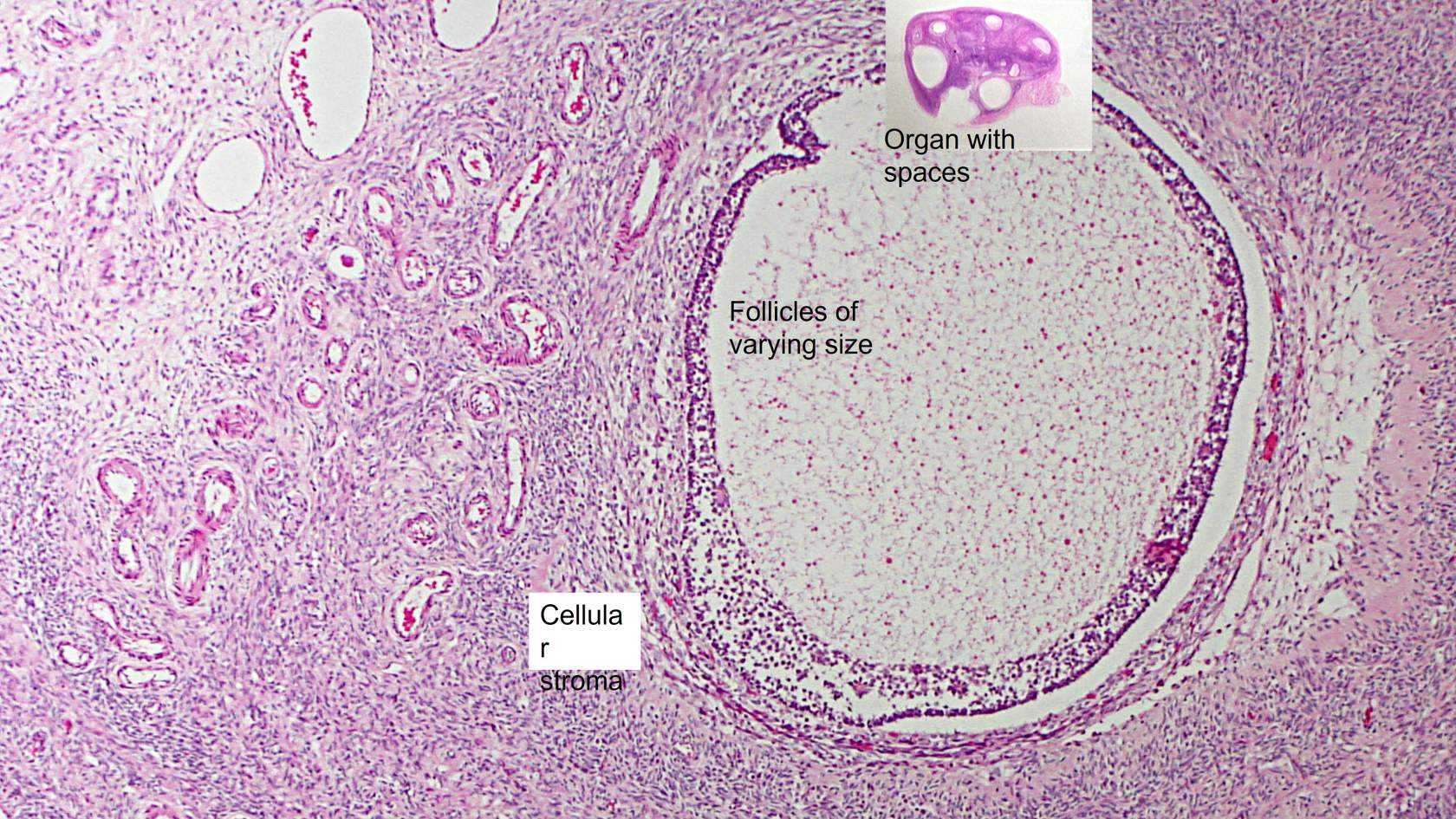 <p>Ovary. Organ with spaces. Micro: Round spaces are follicles with no epithelial lining. cellular space.</p>