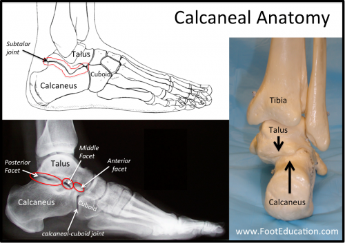 <p>By the ankle, like the calcaneal muscle/calcaneus bone </p>