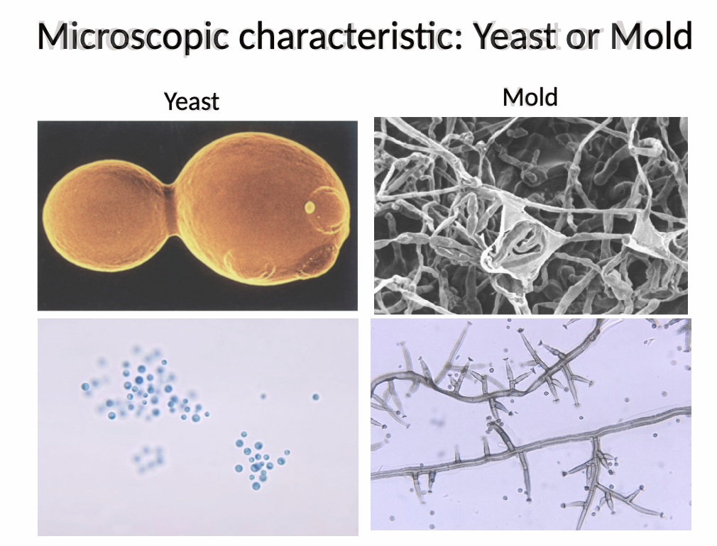 <p><span data-name="star" data-type="emoji">⭐</span> 6. Q: Which microscopic characteristics can be used to characterize different fungi? </p><p></p>