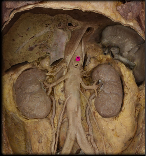 <p>supplies abdominal digestive organs</p>