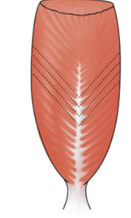 <p>What kind of muscle shape is this? Describe it.</p>