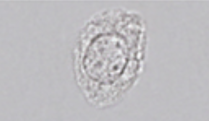 <p>Slightly larger than WBC, eccentric nucleus, 1:1 N:C</p><p>Seen with tubular injury (Slight increase is normal in neonates)</p>